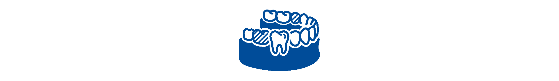 Software CAD Chairside | Diseño digital preciso de restauraciones dentales