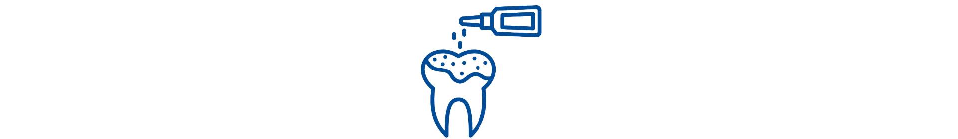 Recubrimiento y Sellado dental  Protección y confort clínico