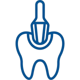 Reducción Oclusal